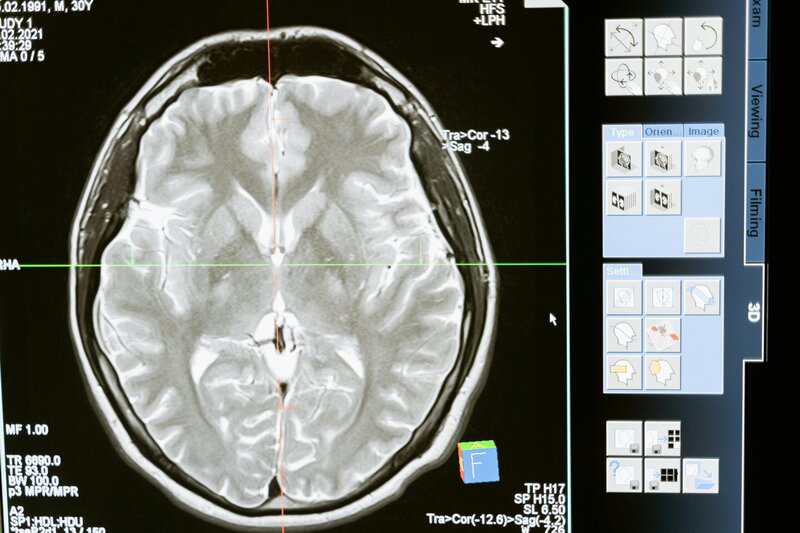 15 Mind-Bending Facts About Déjà Vu That Will Make You Question Reality
