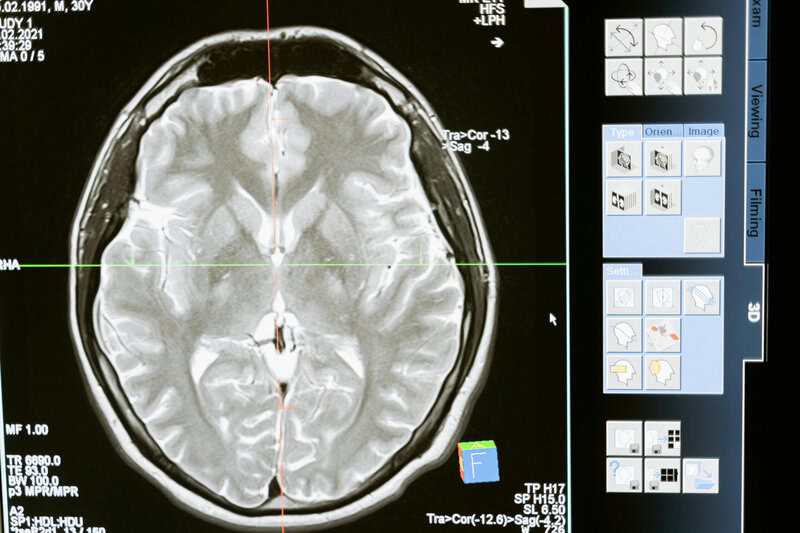 15 Creepy, Cool Things Neuroscientists Know About Your Brain