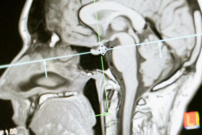 15 Creepy, Cool Things Neuroscientists Know About Your Brain