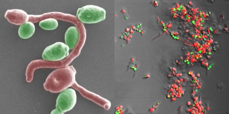 The Microscopic Vampire That Could Cure Candida Infections