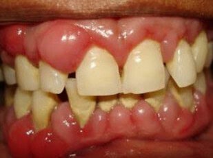 The Surprising Link Between Dental Health and Heart Disease in Seniors
