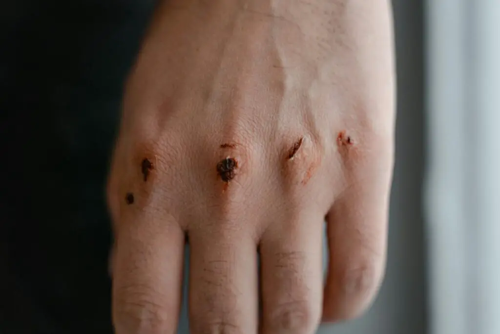 The Woman Who Lives Without Pain—And the Dark Secret Her DNA Revealed
