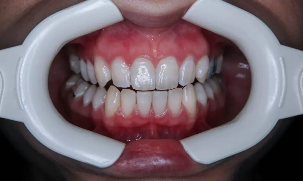 The Surprising Link Between Dental Health and Heart Disease in Seniors