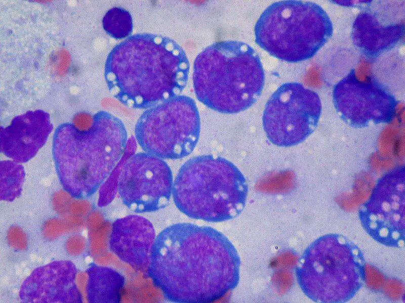 15 Recent Studies That Could Lead to Cures in the Next Decade