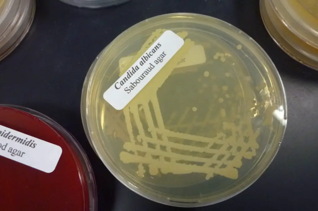 The Microscopic Vampire That Could Cure Candida Infections