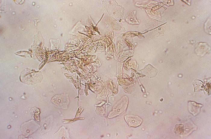 The Microscopic Vampire That Could Cure Candida Infections