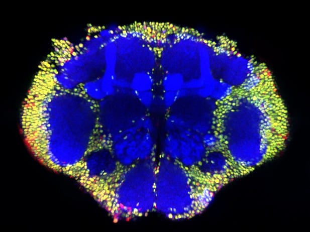 Scientists Map 140,000 Neurons in Fruit Fly Brain – Here’s What It Reveals About Human Memory