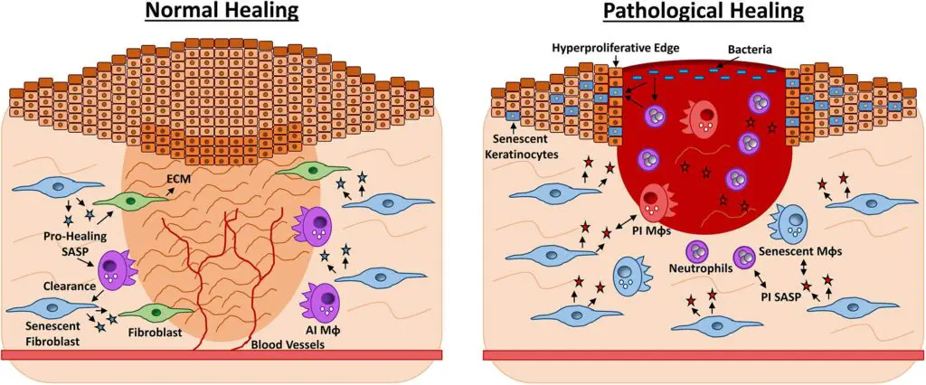 This One Vitamin Became the Secret Weapon in Wound Healing – Breakthrough Discovery