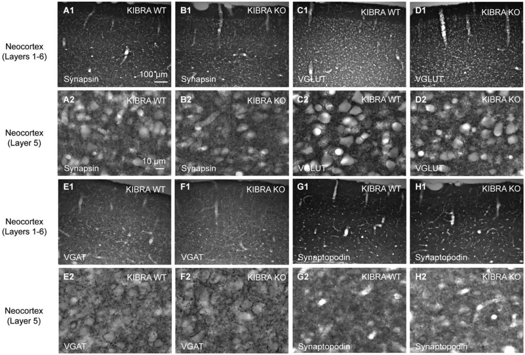 The Protein That Lets Memories Last Forever – KIBRA’s Role in Long-Term Memory
