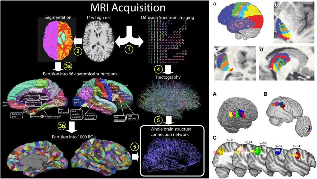 Scientists Map 140,000 Neurons in Fruit Fly Brain – Here’s What It Reveals About Human Memory