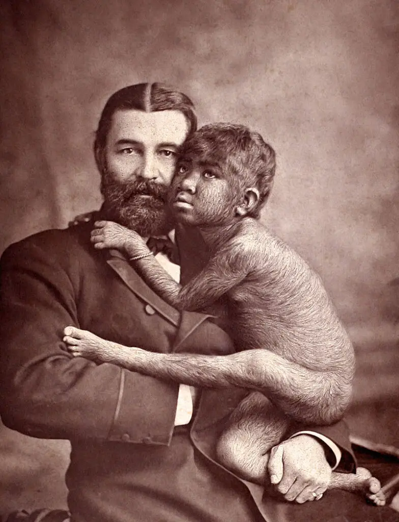 15 Strange Medical Conditions That Sound Made Up—but Aren’t