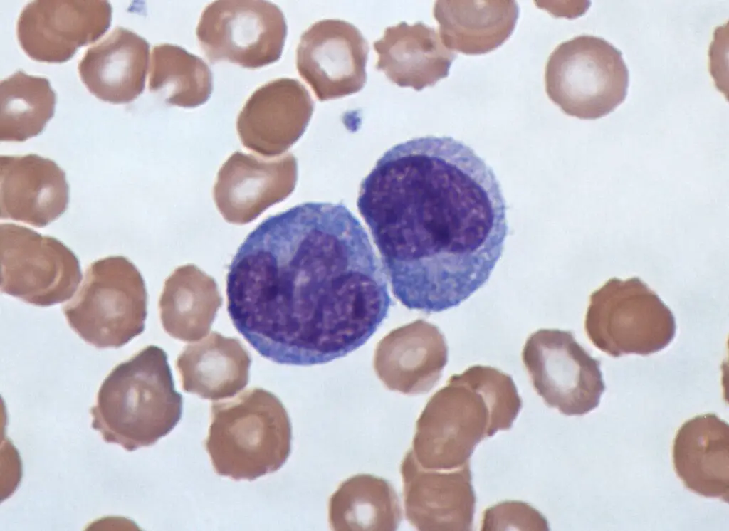 Why Some People Never Get Sick—The Genetic Lottery That Creates Super Immune Systems