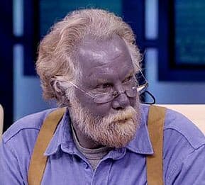 15 Strange Medical Conditions That Sound Made Up—but Aren’t