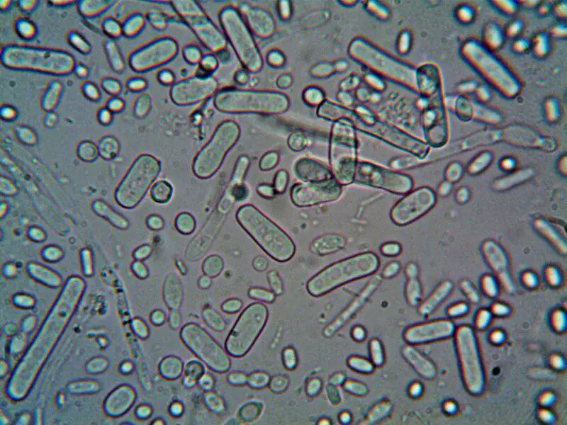 The Bacteria That Eat Plastic Waste Are Evolving Faster Than Expected