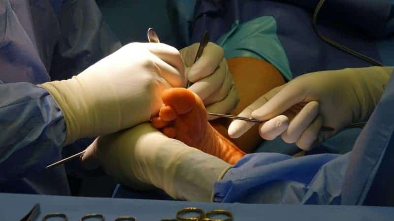 This One Vitamin Became the Secret Weapon in Wound Healing – Breakthrough Discovery