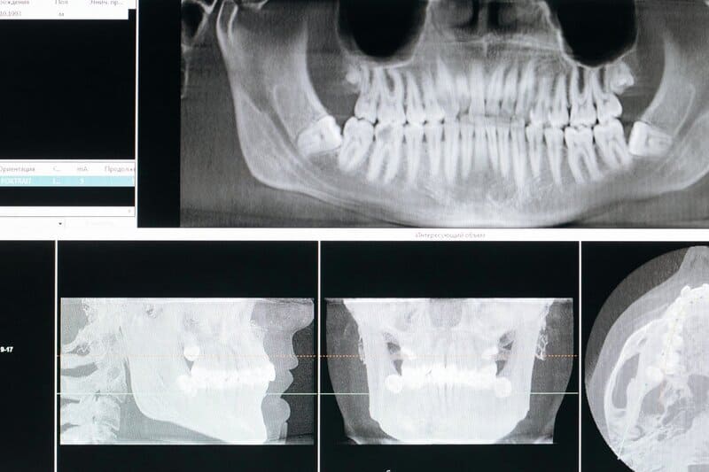 The Surprising Link Between Dental Health and Heart Disease in Seniors