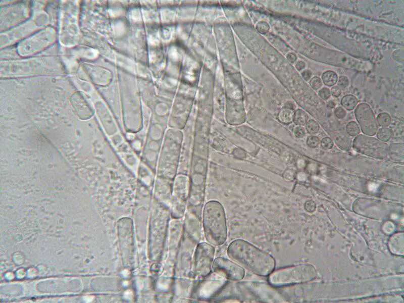 The Microscopic Vampire That Could Cure Candida Infections