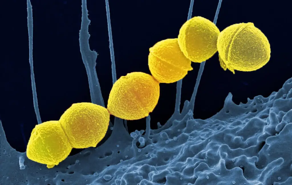 The Gut Health Revolution: How Probiotics Work Differently in Younger and Older Bodies