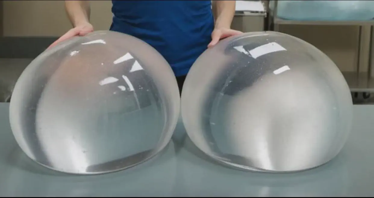 19 Mammoth Marvels That Are Too Big to Ignore! đ 31 Absolute Units of 4000cc breast implants