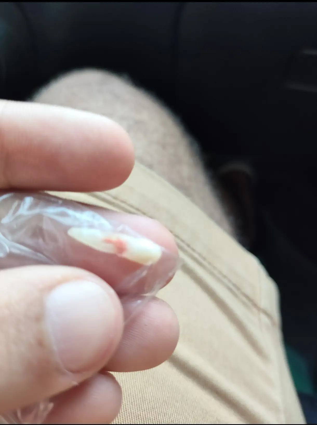 16 Mammoth Oddities You Need to See Now! đđŸ 33 Absolute Units of a Baby tooth