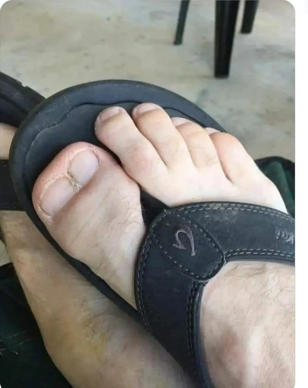 22 Absolute Beasts That Will Leave You in Awe! đŸđ„ 36 Absolute Units of a big toe