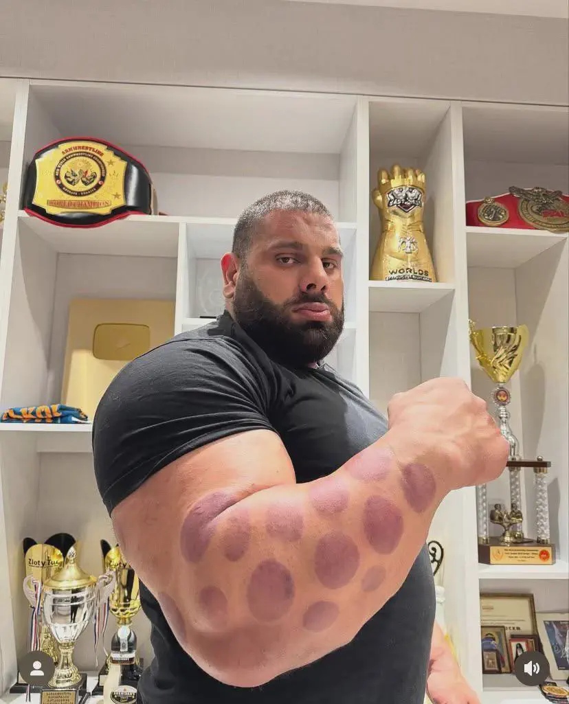 20 Enormous Oddities That Will Astound You! đŠđ 41 Absolute Units of an arm (Levan Saginashvili 6'3