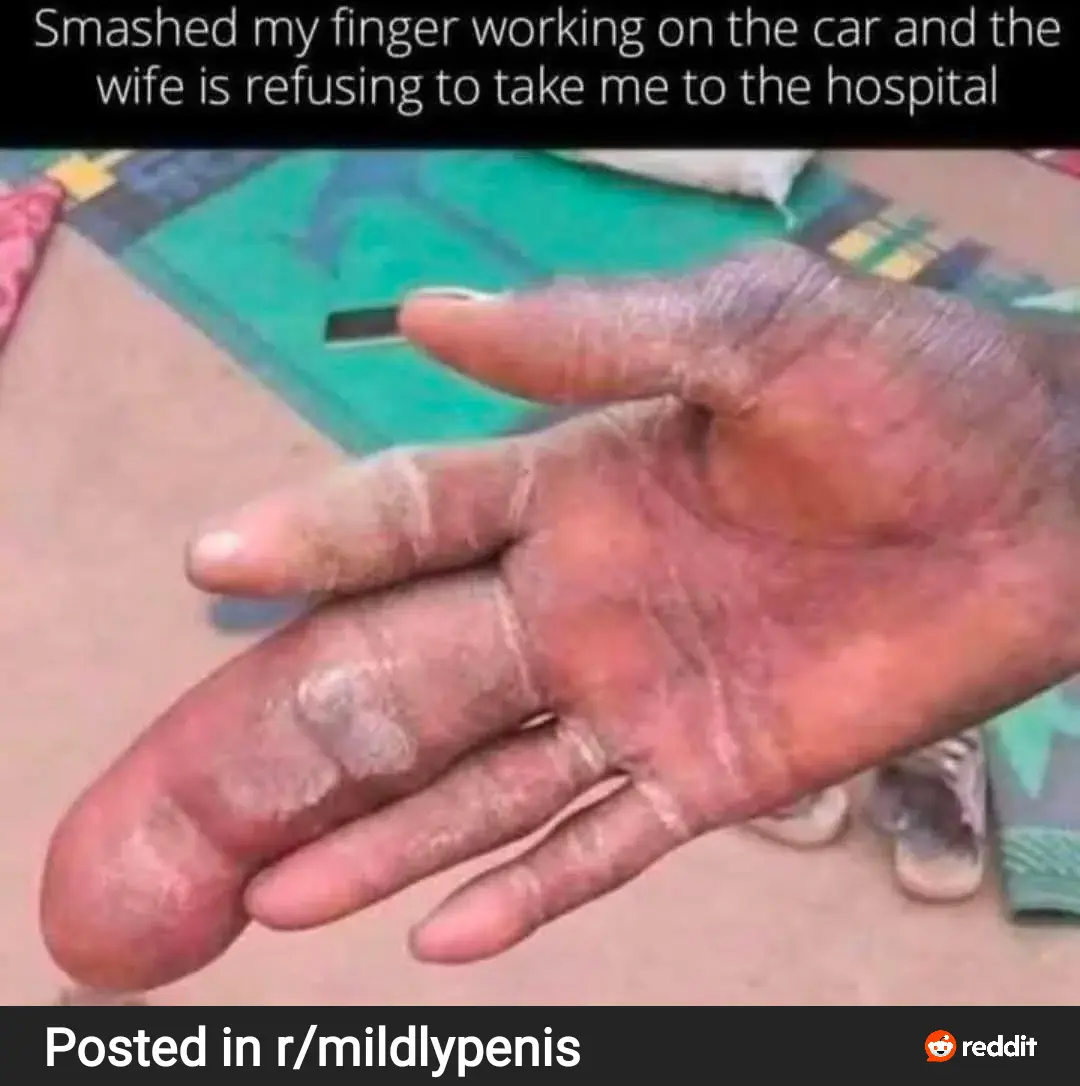 7 Outrageously Large Oddities You Need to See! 🌪️🔥 10 Absolute Units of a middle finger