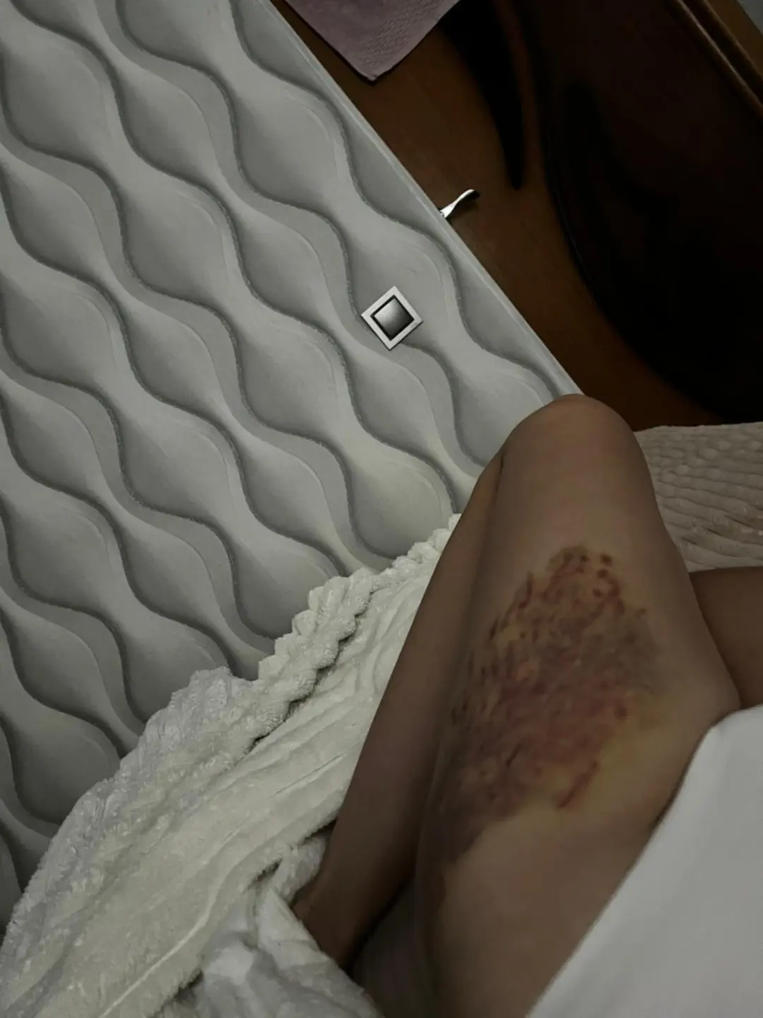 13 Extraordinary Giants Ready to Blow Your Mind! đ 27 Absolute Units of a bruise.