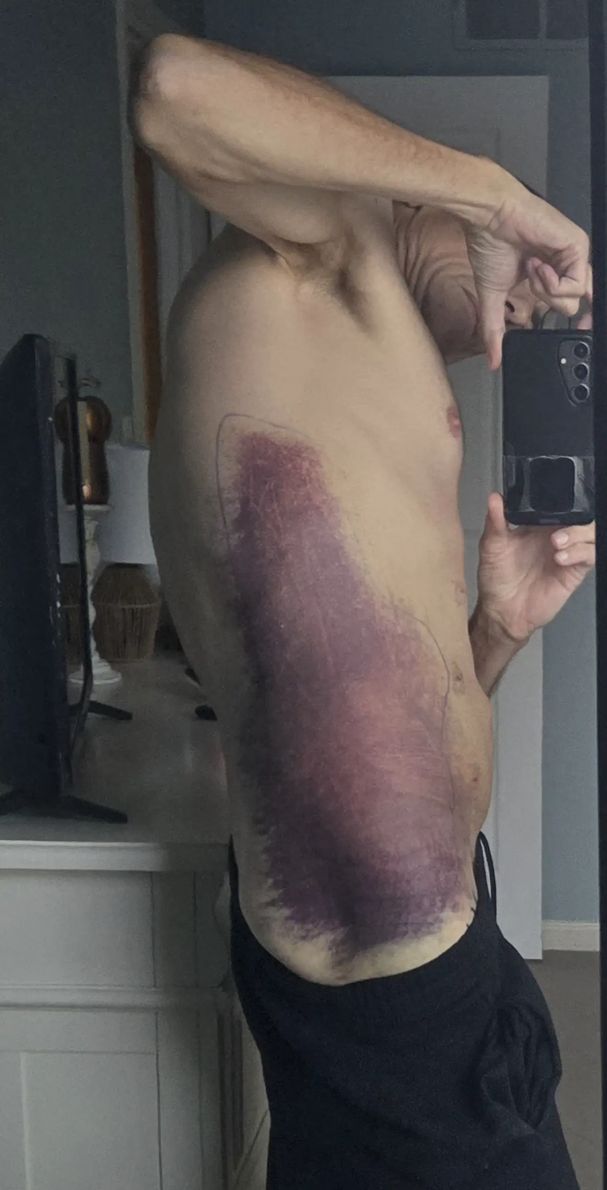 9 Incredible Absolute Units Transforming Size Expectations! đ„ 18 Absolute Units of a bruise... 72 hrs later....