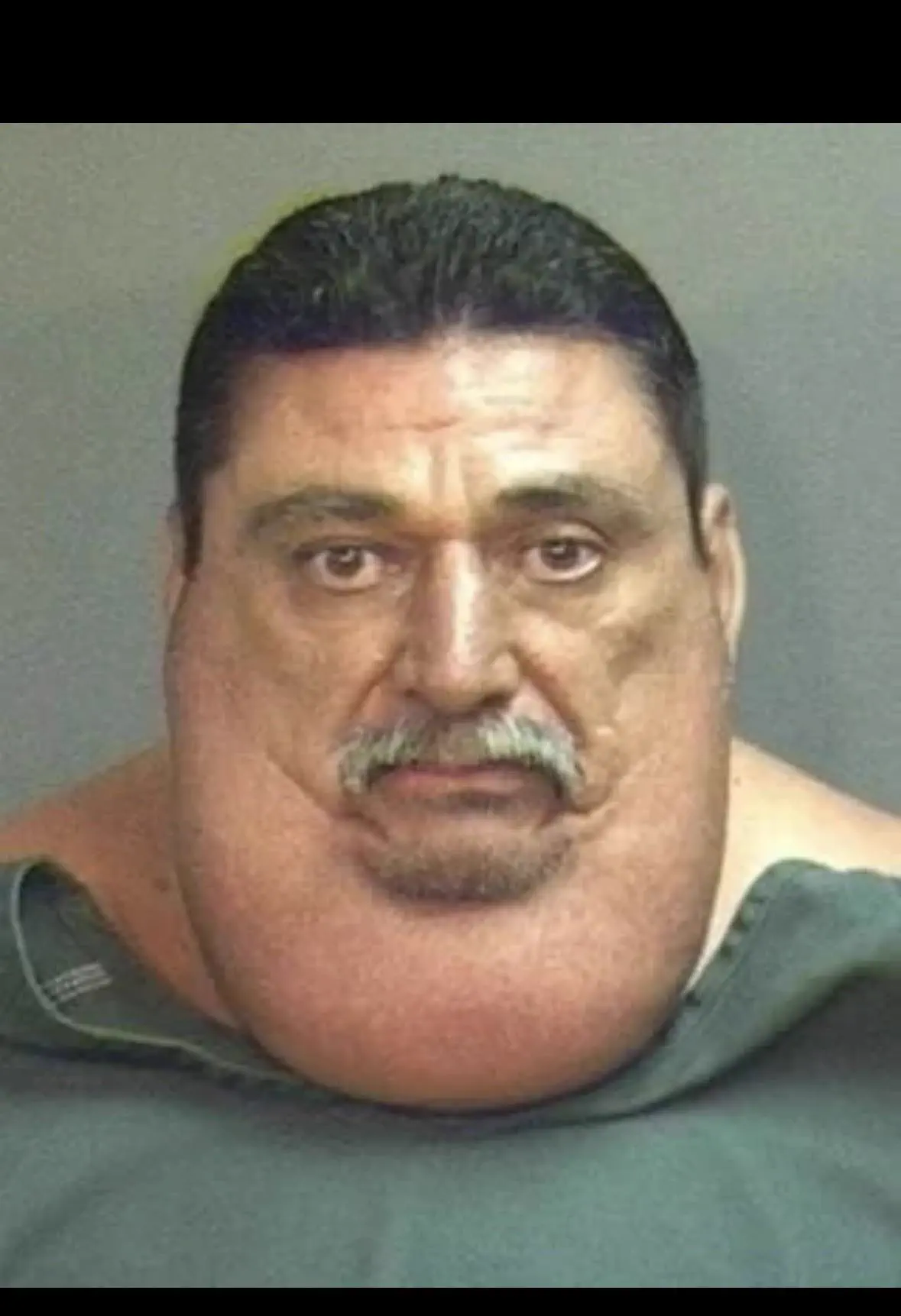 8 Absolute Units That Made Us Question Reality 🫣 18 Confusingly large chin or neck that defies anatomical logic