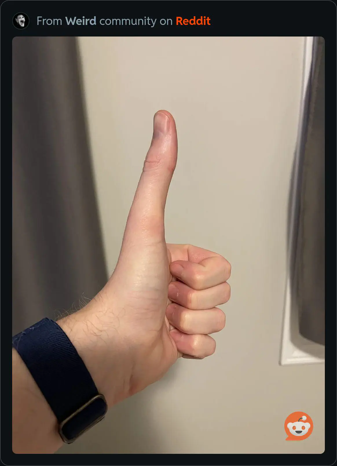 Absolute Units of a thumb