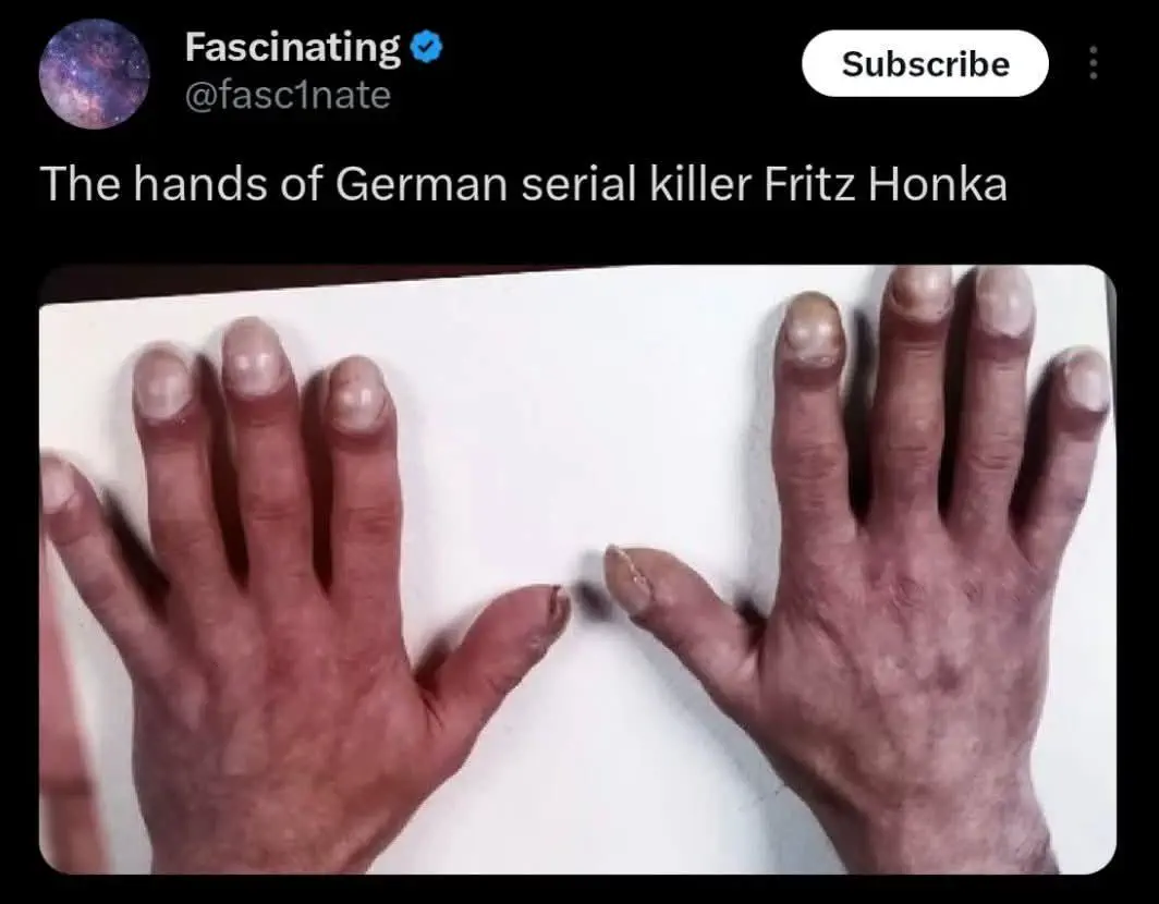 10 Breathtaking Oddities Exceeding Your Size Expectations! đ€Żđ 20 Absolute Units of serial killing hands