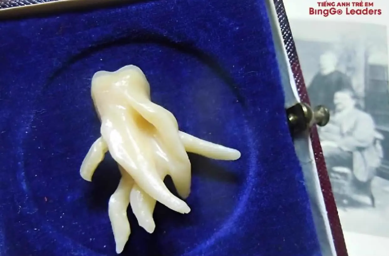 12 Huge Icons Redefining What Massive Truly Means! 🌍🐾 17 Absolute Units This wisdom tooth's root.