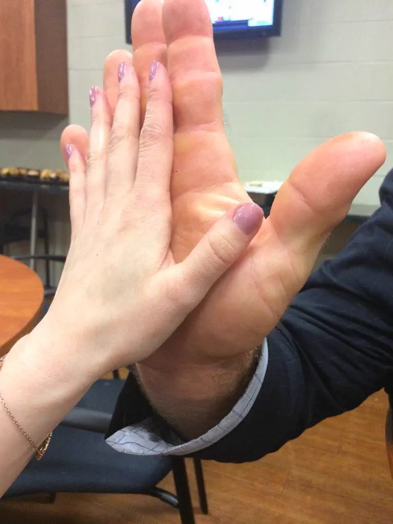 17 Giants That Made Us Question Reality 🫣 26 Absolute Units of a hand