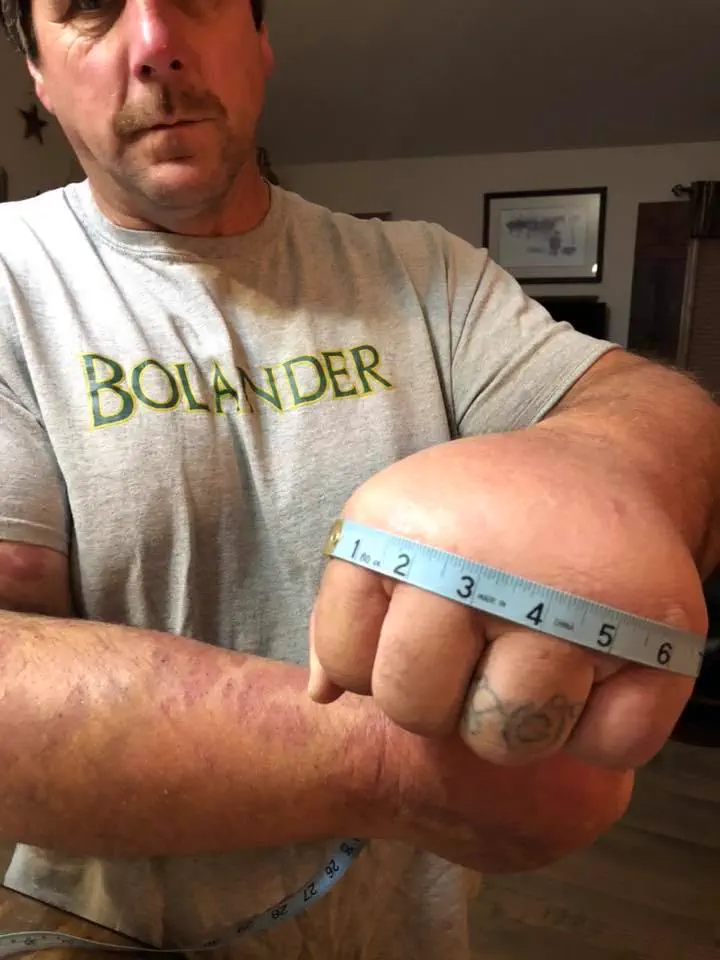 These 6 Absolute Units Are on Another Level đł 12 Absolute Units of a hand