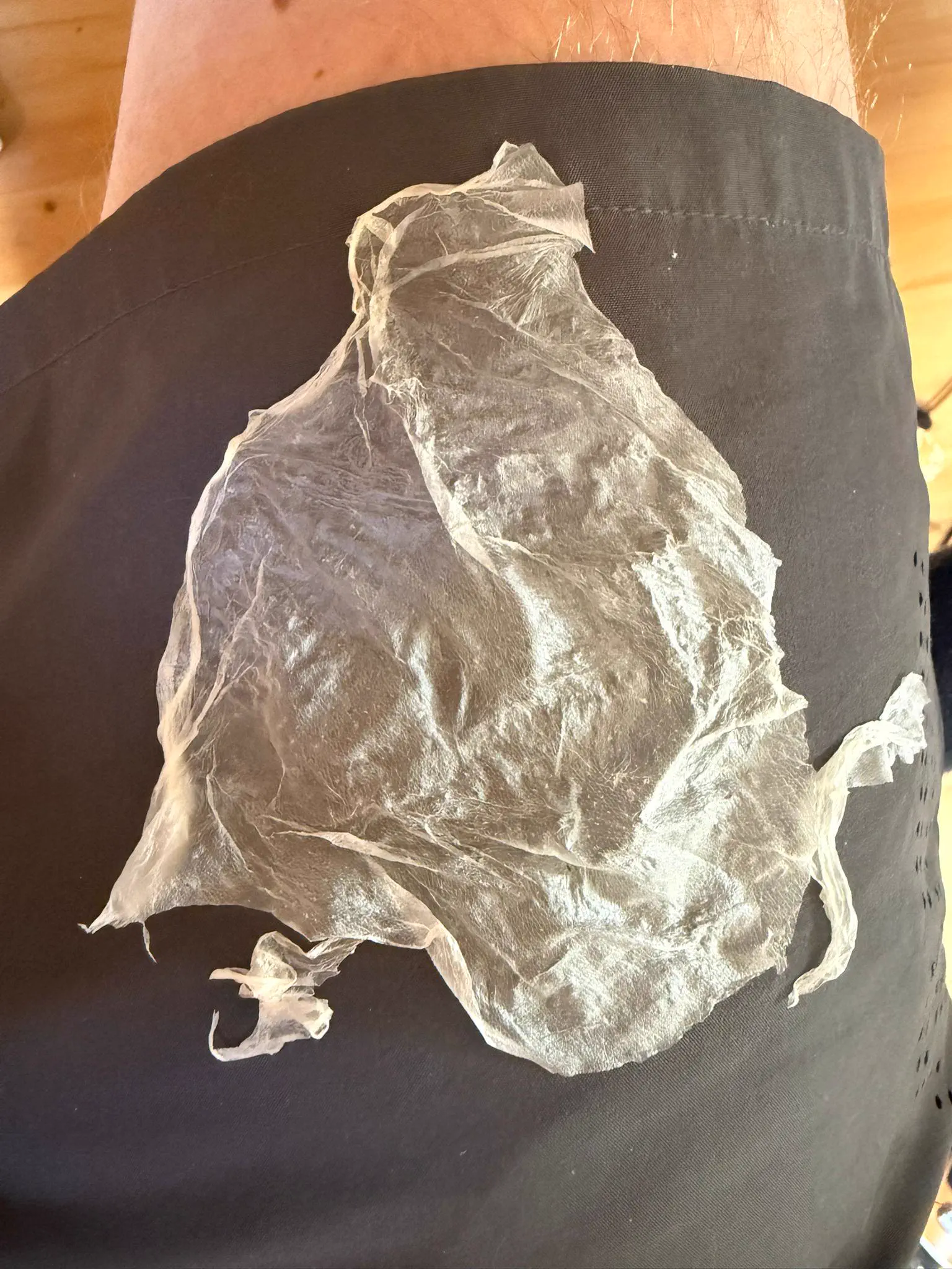 8 Things So Big They Glitched Reality Itself đ« 17 Unusually large skin flake that shocked the internet with its size