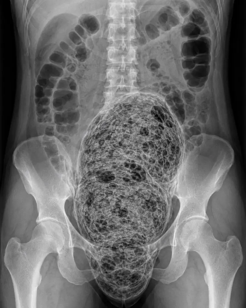 Why Are These 11 Things So Absurdly Oversized? 🫠 36 absolute units of a turd