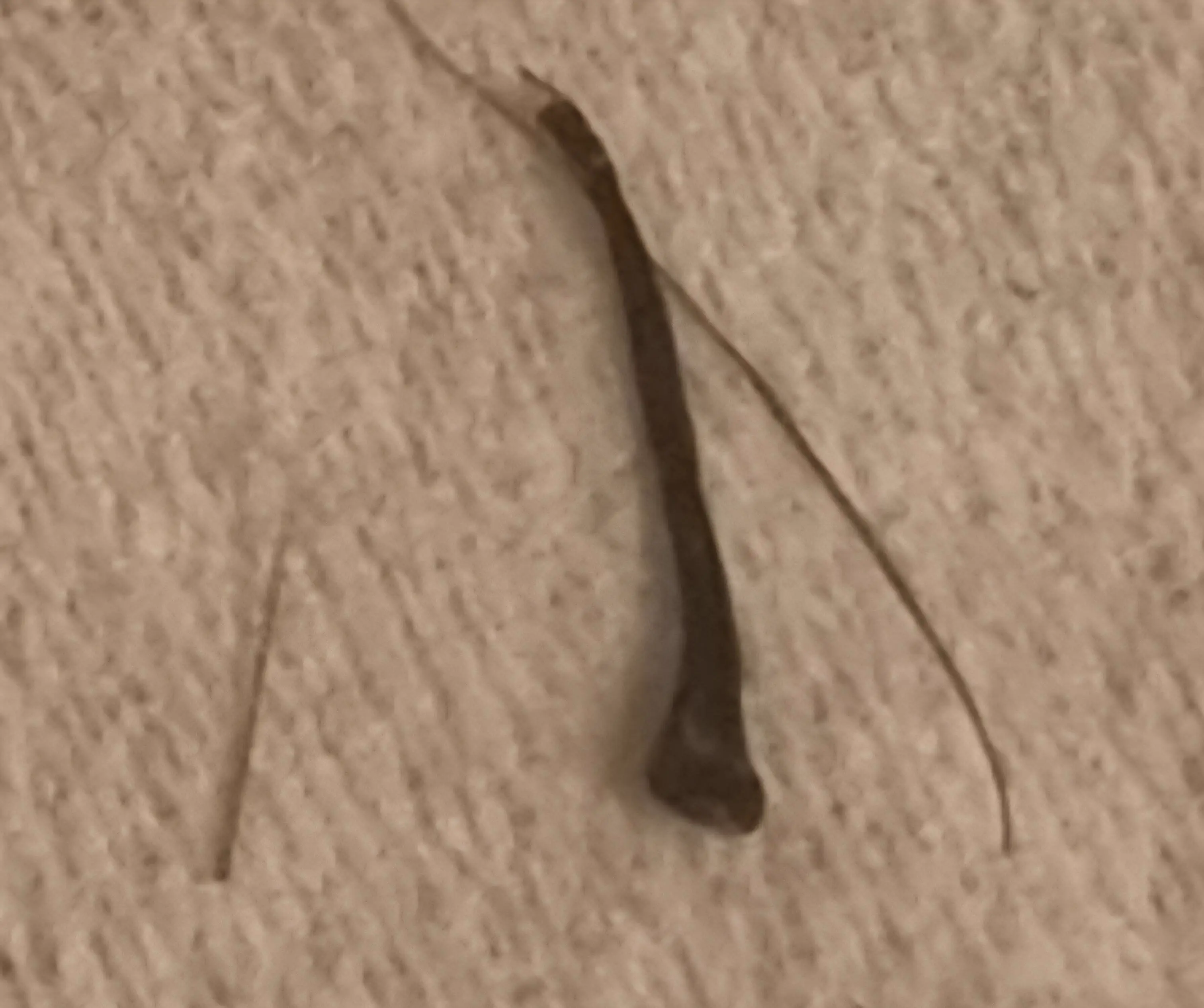8 Oversized Things That Had No Right Existing 🫣 18 Absolute Units of ingrown hair next to 2 normal ones