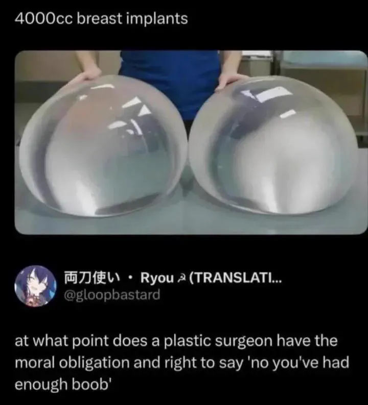8 Things So Big They Glitched Reality Itself đ« 10 absolute units of the breast implants