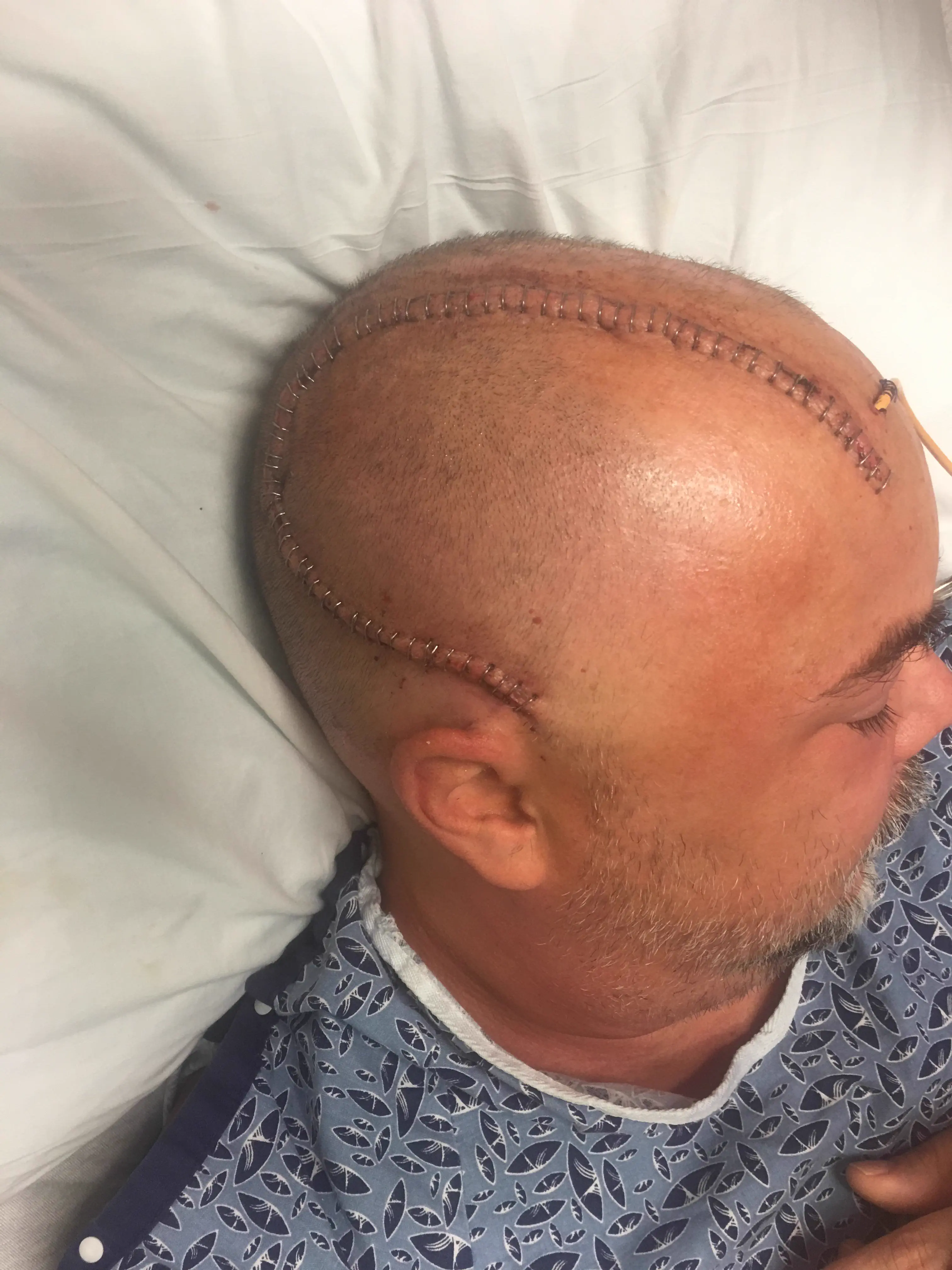 The 6 Most Enormous Absolute Units Spotted Online 🤯 14 Absolute Units of my Scar